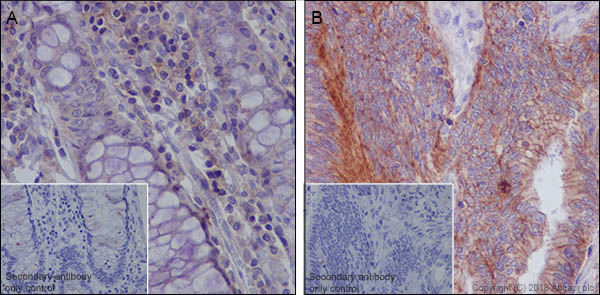 Immunohistochemistry (Formalin/PFA-fixed paraffin-embedded sections) - Anti-MRP1 antibody [EPR21061] (AB230948), expandable thumbnail
