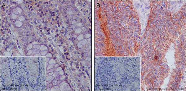 Immunohistochemistry (Formalin/PFA-fixed paraffin-embedded sections) - Anti-MRP1 antibody [EPR21061] (AB230948)