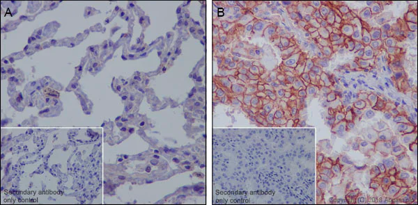 Immunohistochemistry (Formalin/PFA-fixed paraffin-embedded sections) - Anti-MRP1 antibody [EPR21061] - BSA and Azide free (AB234104)