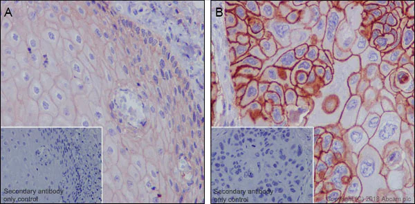 Immunohistochemistry (Formalin/PFA-fixed paraffin-embedded sections) - Anti-MRP1 antibody [EPR21061] - BSA and Azide free (AB234104)