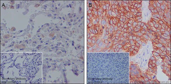 Immunohistochemistry (Formalin/PFA-fixed paraffin-embedded sections) - Anti-MRP1 antibody [EPR21062] (AB233383)