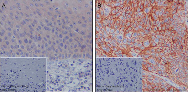 Immunohistochemistry (Formalin/PFA-fixed paraffin-embedded sections) - Anti-MRP1 antibody [EPR21062] (AB233383)