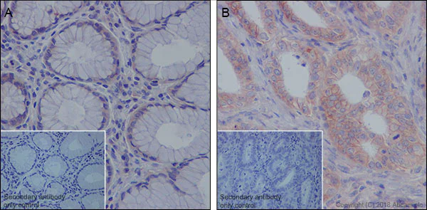 Immunohistochemistry (Formalin/PFA-fixed paraffin-embedded sections) - Anti-MRP1 antibody [EPR21062] (AB233383)