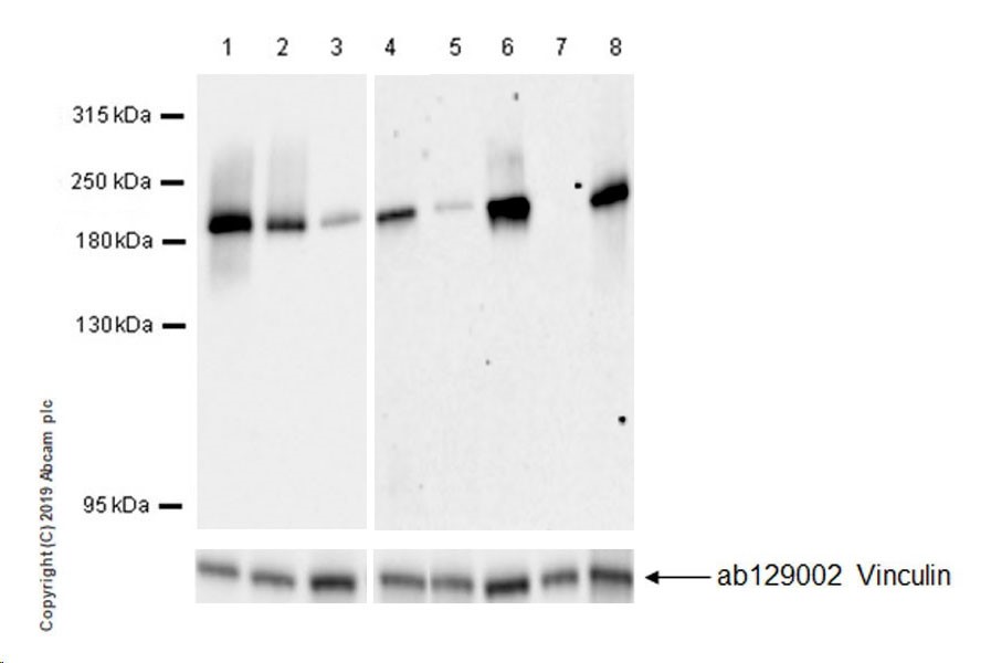 Western blot - Anti-MRP1 antibody [EPR22841-78] (AB260038), expandable thumbnail