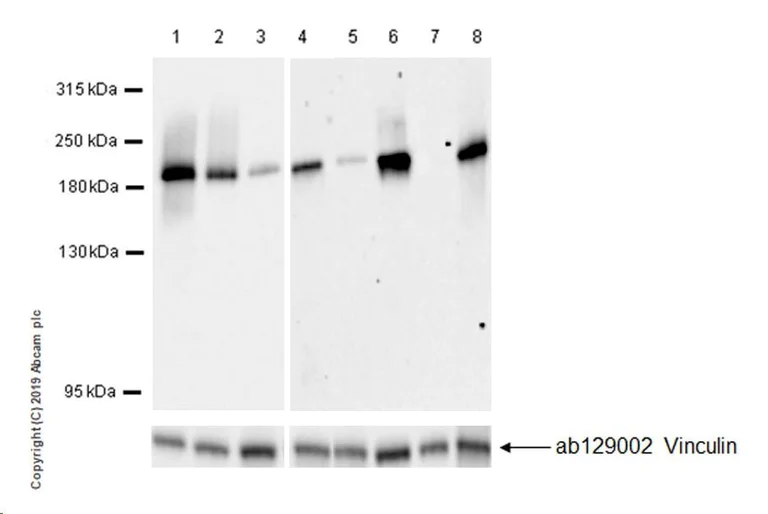 Western blot - Anti-MRP1 antibody [EPR22841-78] (AB260038)