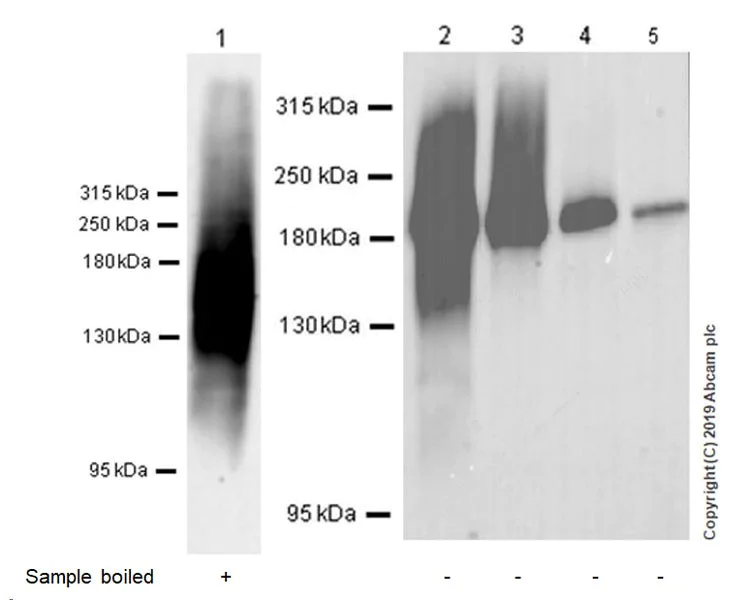 Western blot - Anti-MRP1 antibody [EPR22841-78] (AB260038)