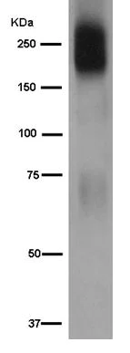Western blot - Anti-MRP1 antibody [EPR4658(2)] - BSA and Azide free (AB250288)