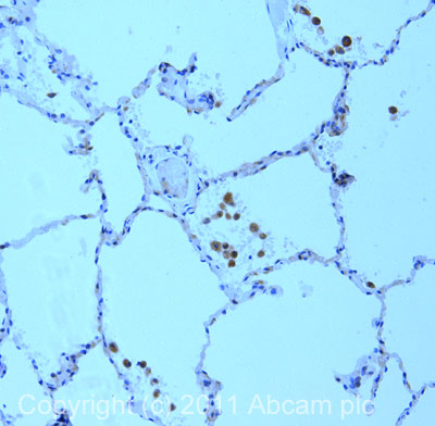 Immunohistochemistry (Formalin/PFA-fixed paraffin-embedded sections) - Anti-MRP1 antibody [MRPr1] (AB3368), expandable thumbnail