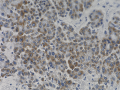 Immunohistochemistry (Formalin/PFA-fixed paraffin-embedded sections) - Anti-MRP1 antibody [MRPr1] (AB3368), expandable thumbnail
