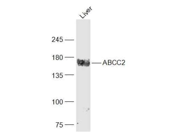 Western blot - Anti-MRP2 antibody (AB203397)