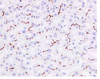 Immunohistochemistry (Formalin/PFA-fixed paraffin-embedded sections) - Anti-MRP2 antibody [EPR10997(2)] (AB187644)