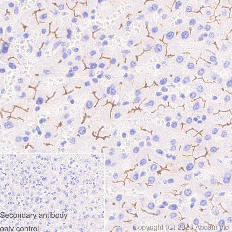 Immunohistochemistry (Formalin/PFA-fixed paraffin-embedded sections) - Anti-MRP2 antibody [EPR10998] (AB172630)