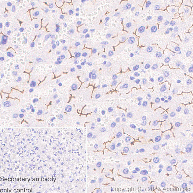 Immunohistochemistry (Formalin/PFA-fixed paraffin-embedded sections) - Anti-MRP2 antibody [EPR10998] (AB172630)