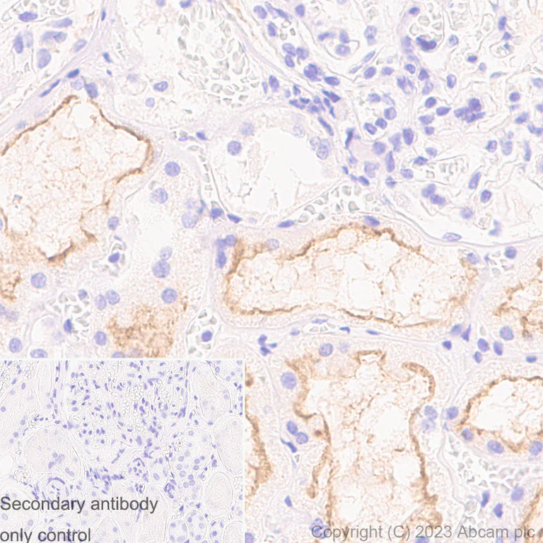 Immunohistochemistry (Formalin/PFA-fixed paraffin-embedded sections) - Anti-MRP2 antibody [EPR10998] (AB172630)