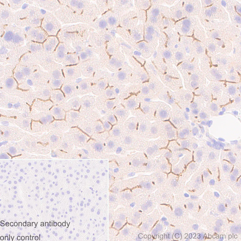 Immunohistochemistry (Formalin/PFA-fixed paraffin-embedded sections) - Anti-MRP2 antibody [EPR10998] (AB172630)