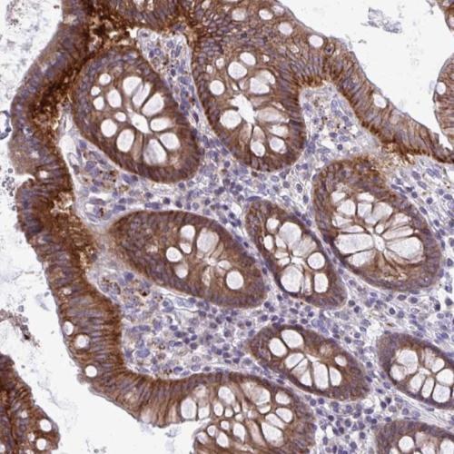 Immunohistochemistry (Formalin/PFA-fixed paraffin-embedded sections) - Anti-MRP3 antibody (AB204322)