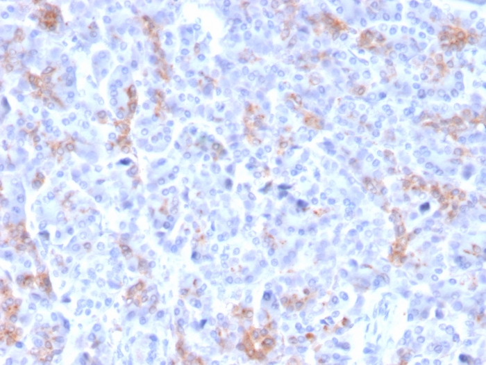 Immunohistochemistry (Formalin/PFA-fixed paraffin-embedded sections) - Anti-MRP3 antibody [ABCC3/2971] - BSA and Azide free (AB268263)