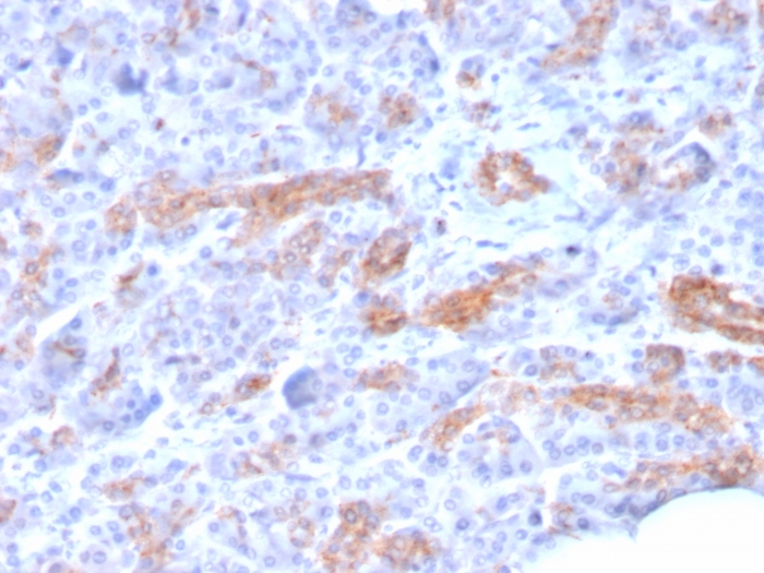 Immunohistochemistry (Formalin/PFA-fixed paraffin-embedded sections) - Anti-MRP3 antibody [ABCC3/2971] - BSA and Azide free (AB268263)