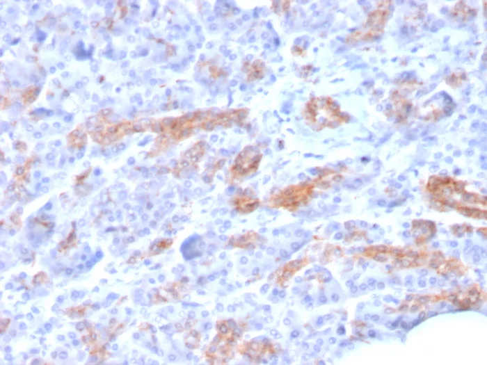 Immunohistochemistry (Formalin/PFA-fixed paraffin-embedded sections) - Anti-MRP3 antibody [ABCC3/2971] - BSA and Azide free (AB268263)