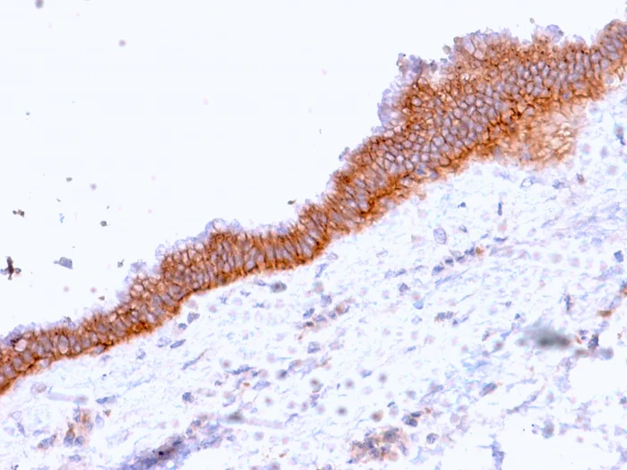 Immunohistochemistry (Formalin/PFA-fixed paraffin-embedded sections) - Anti-MRP3 antibody [ABCC3/2971] - BSA and Azide free (AB268263)