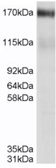 Western blot - Anti-MRP4 antibody (AB77184), expandable thumbnail