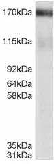 Western blot - Anti-MRP4 antibody (AB77184)