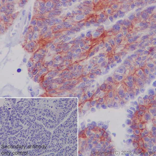 Immunohistochemistry (Formalin/PFA-fixed paraffin-embedded sections) - Anti-MRP4 antibody [EPR20403] - BSA and Azide free (AB235624)