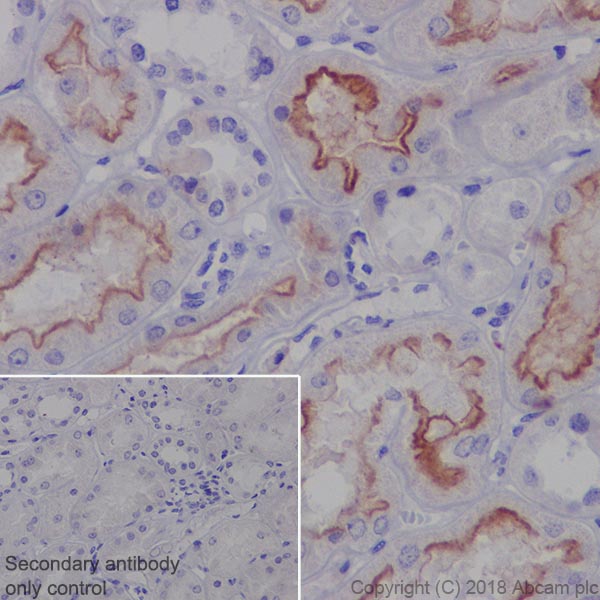 Immunohistochemistry (Formalin/PFA-fixed paraffin-embedded sections) - Anti-MRP4 antibody [EPR20403] - BSA and Azide free (AB235624), expandable thumbnail