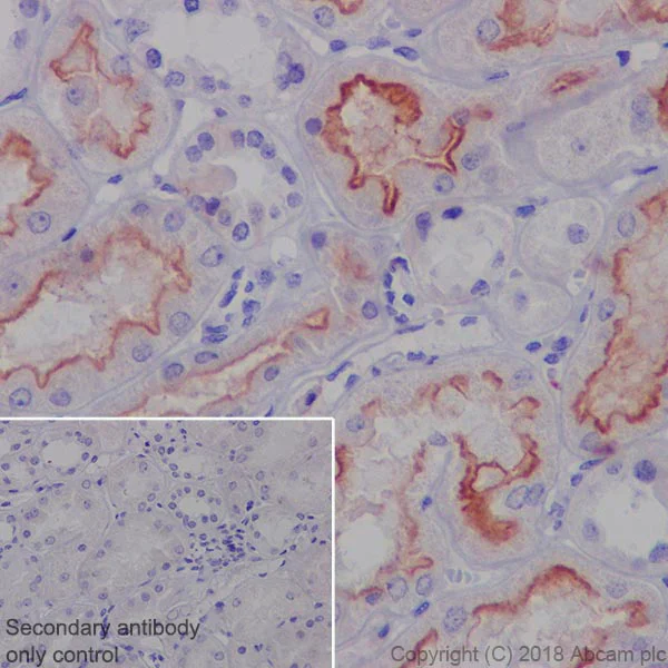 Immunohistochemistry (Formalin/PFA-fixed paraffin-embedded sections) - Anti-MRP4 antibody [EPR20403] - BSA and Azide free (AB235624)
