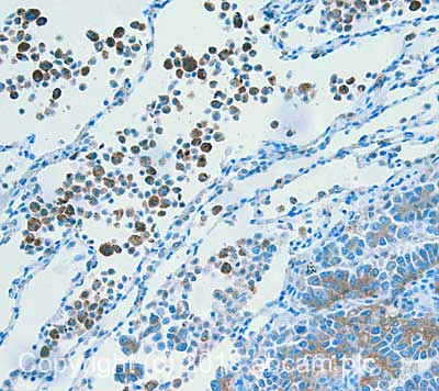 Immunohistochemistry (Formalin/PFA-fixed paraffin-embedded sections) - Anti-MRP4 antibody [M4I-10] (AB15602)