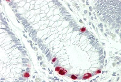 Immunohistochemistry (Formalin/PFA-fixed paraffin-embedded sections) - Anti-MRP5 antibody [6C6] (AB230674)