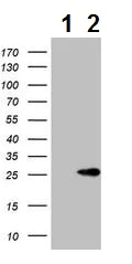 Western blot - Anti-MRP5 antibody [6C6] (AB230674)