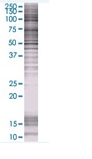 MRP6/ARA overexpression 293T lysate (whole cell)