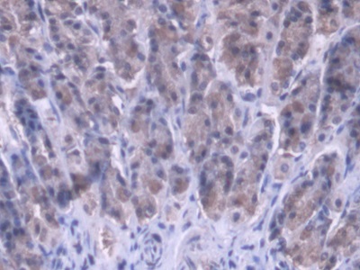 Immunohistochemistry (Formalin/PFA-fixed paraffin-embedded sections) - Anti-MRPL1 antibody (AB231060)