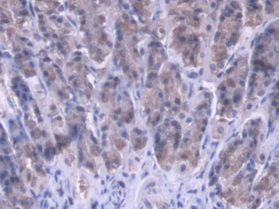 Immunohistochemistry (Formalin/PFA-fixed paraffin-embedded sections) - Anti-MRPL1 antibody (AB231060)