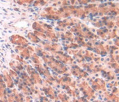 Immunohistochemistry (Formalin/PFA-fixed paraffin-embedded sections) - Anti-MRPL1 antibody (AB231060)
