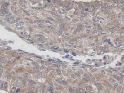Immunohistochemistry (Formalin/PFA-fixed paraffin-embedded sections) - Anti-MRPL1 antibody (AB232886), expandable thumbnail