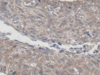 Immunohistochemistry (Formalin/PFA-fixed paraffin-embedded sections) - Anti-MRPL1 antibody (AB232886)