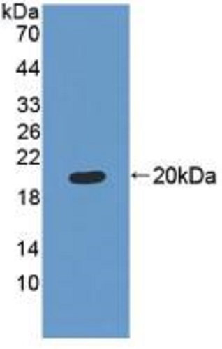 Western blot - Anti-MRPL1 antibody (AB232886), expandable thumbnail