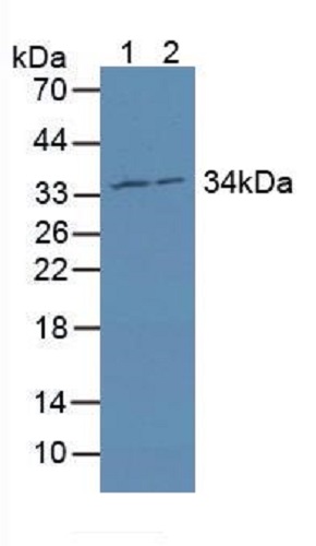Western blot - Anti-MRPL1 antibody (AB232886), expandable thumbnail