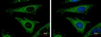 Immunocytochemistry/ Immunofluorescence - Anti-MRPL12 antibody (AB154961)