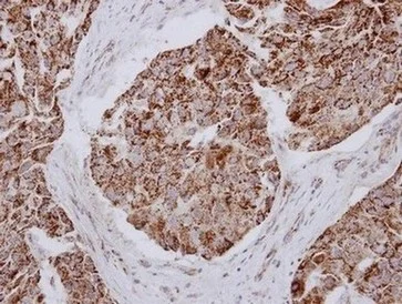 Immunohistochemistry (Formalin/PFA-fixed paraffin-embedded sections) - Anti-MRPL12 antibody (AB154961)