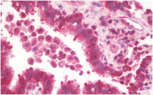 Immunohistochemistry (Formalin/PFA-fixed paraffin-embedded sections) - Anti-MRPL13 antibody (AB190232)