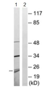 Western blot - Anti-MRPL13 antibody (AB190232)