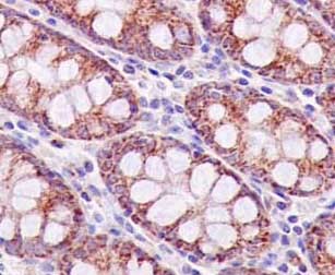 Immunohistochemistry (Formalin/PFA-fixed paraffin-embedded sections) - Anti-MRPL16 antibody [EPR14351-63] (AB181840)