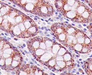 Immunohistochemistry (Formalin/PFA-fixed paraffin-embedded sections) - Anti-MRPL16 antibody [EPR14351-63] (AB181840)
