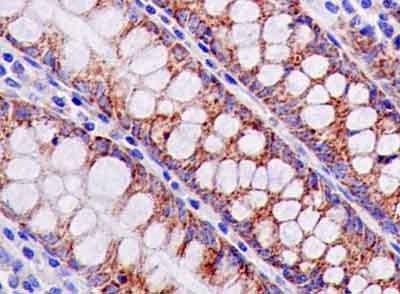 Immunohistochemistry (Formalin/PFA-fixed paraffin-embedded sections) - Anti-MRPL16 antibody [EPR14351] (AB181834)
