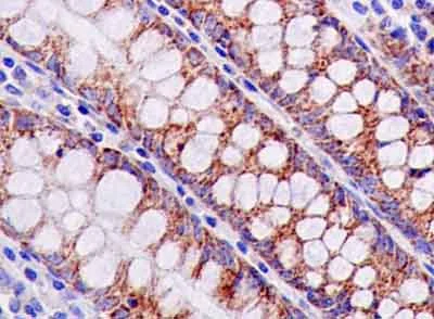 Immunohistochemistry (Formalin/PFA-fixed paraffin-embedded sections) - Anti-MRPL16 antibody [EPR14351] - BSA and Azide free (AB250512)