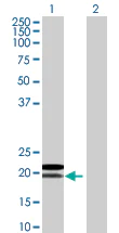 Western blot - Anti-MRPL18 antibody (AB67844)