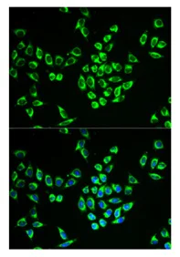 Immunocytochemistry/ Immunofluorescence - Anti-MRPL28 antibody (AB196842)